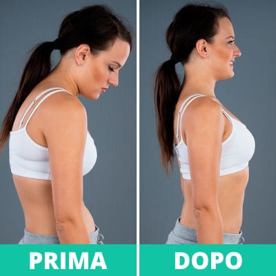 Ok Shoulders Supporto Posturale funziona davvero Recensioni prezzo e dove trovarlo